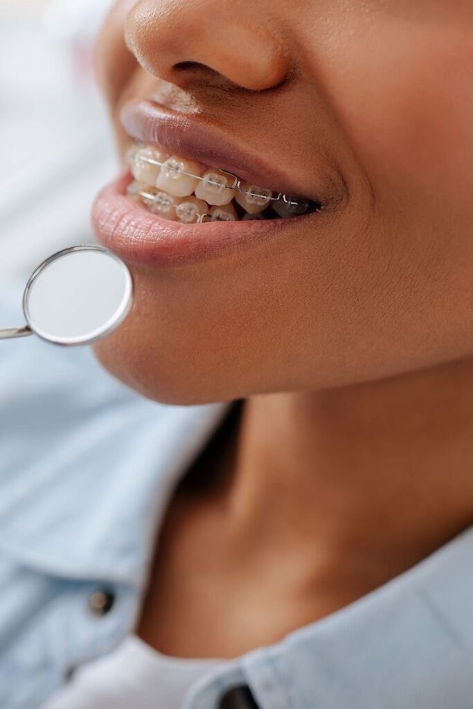 Ортодонтія Брекети Святошино