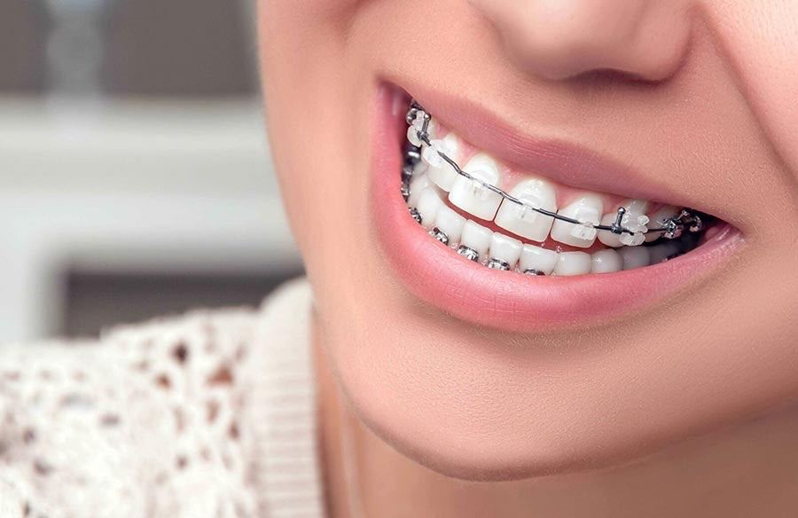 Ортодонтія Брекети Святошино