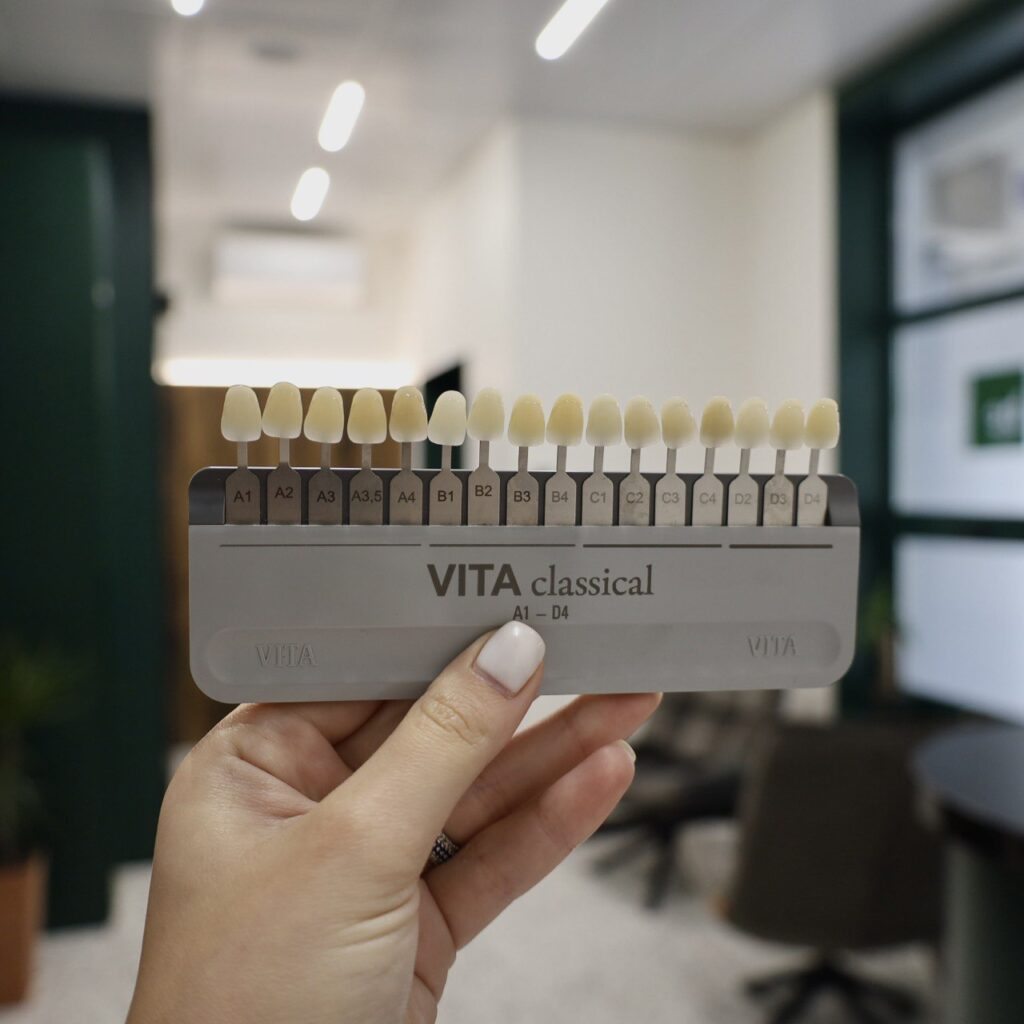 Реставрація зубів